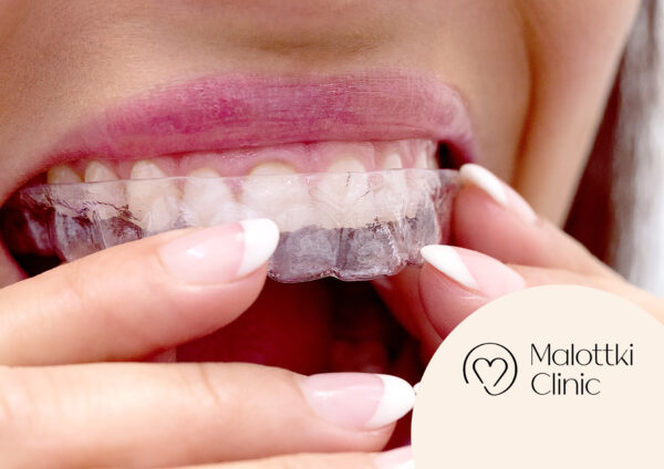 niewidoczny aparat invisalign opole