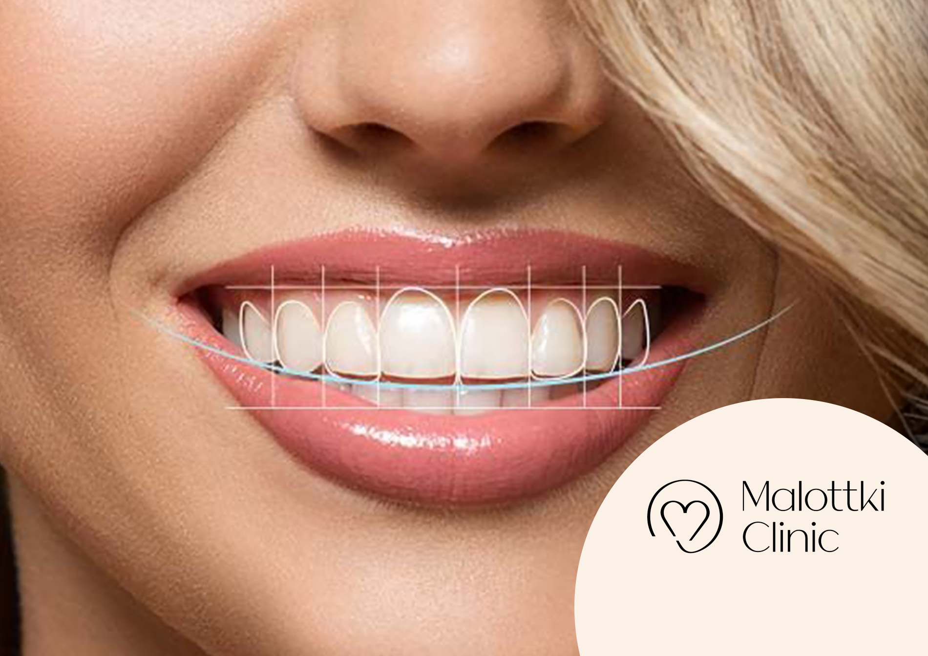 digital smile design opole