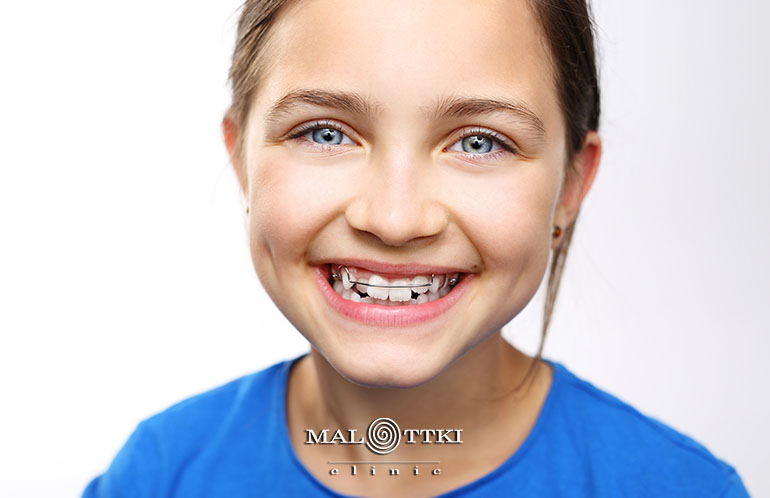 leczenie ortodontyczne dzieci