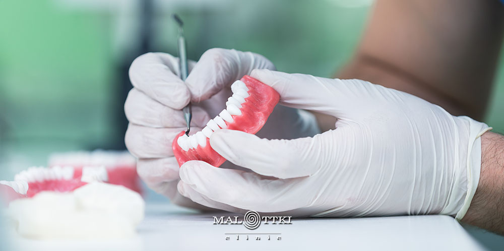 protezy zębowe