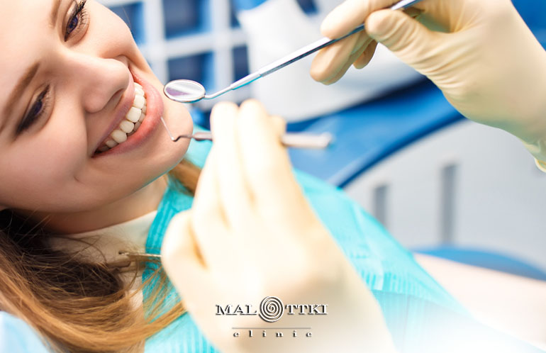 Jakie implanty wybrać