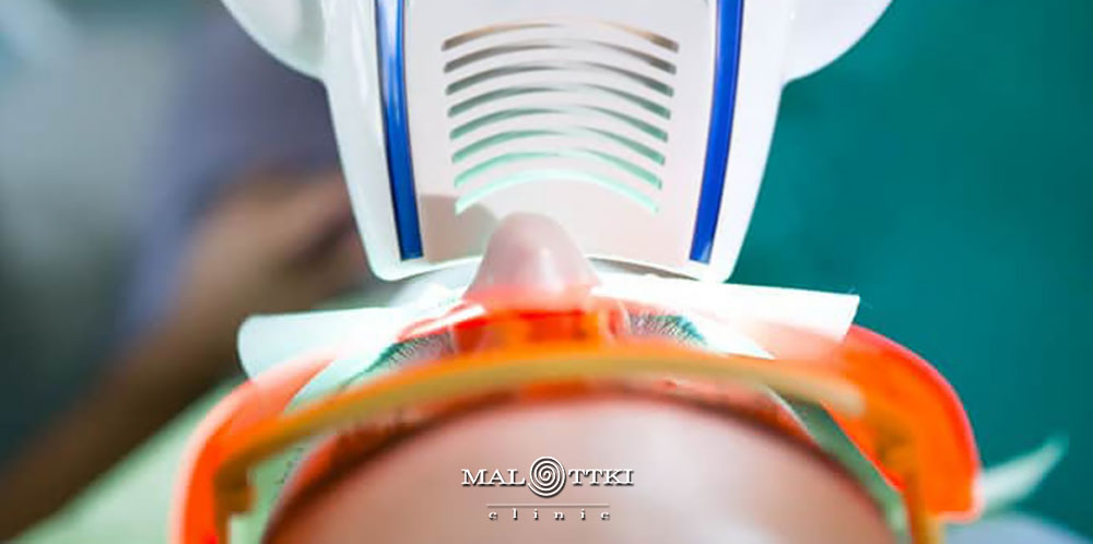 Lampa do wybielania zębów Beyond