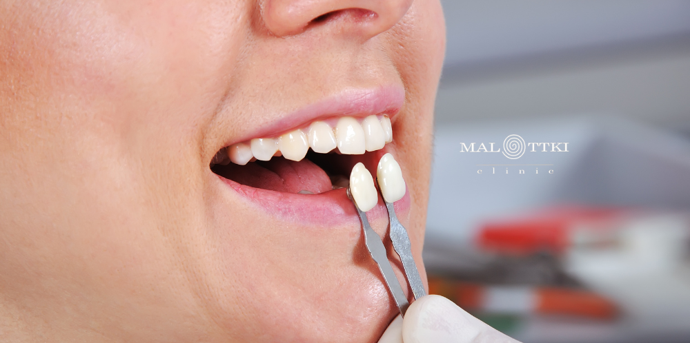 Protetyka w stomatologii