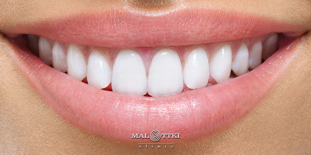 Stomatologia estetyczna w Opolu