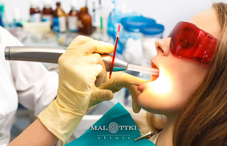 Wypełnienie zębów w Opolu