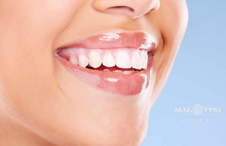 Zabiegi estetyczne w stomatologii